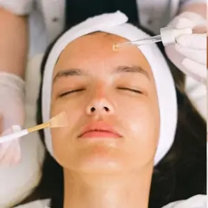 Peeling chemiczny